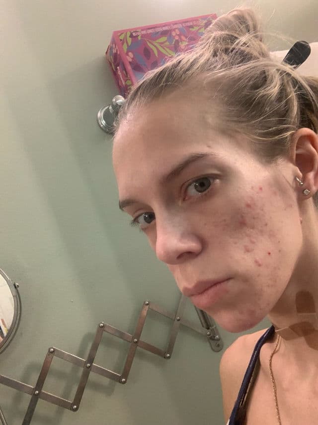 Murad Daily Clarifying Peel review photo by ReneeEgan