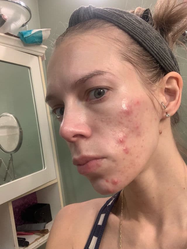 Murad Daily Clarifying Peel review photo by ReneeEgan