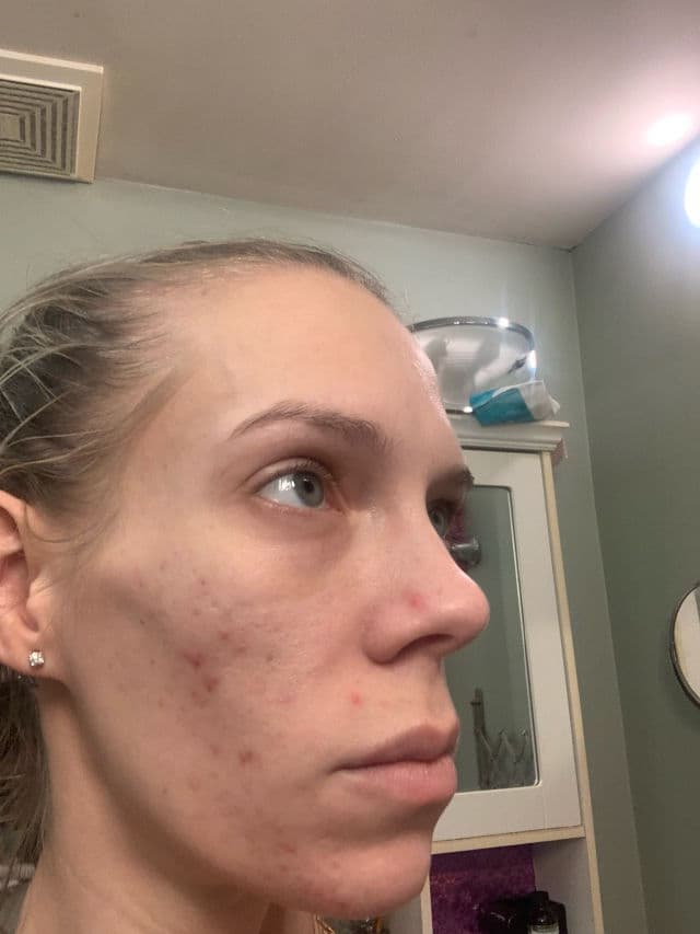 Murad Daily Clarifying Peel review photo by ReneeEgan