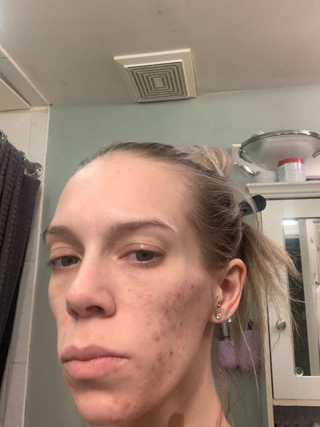 Murad Daily Clarifying Peel review photo by ReneeEgan
