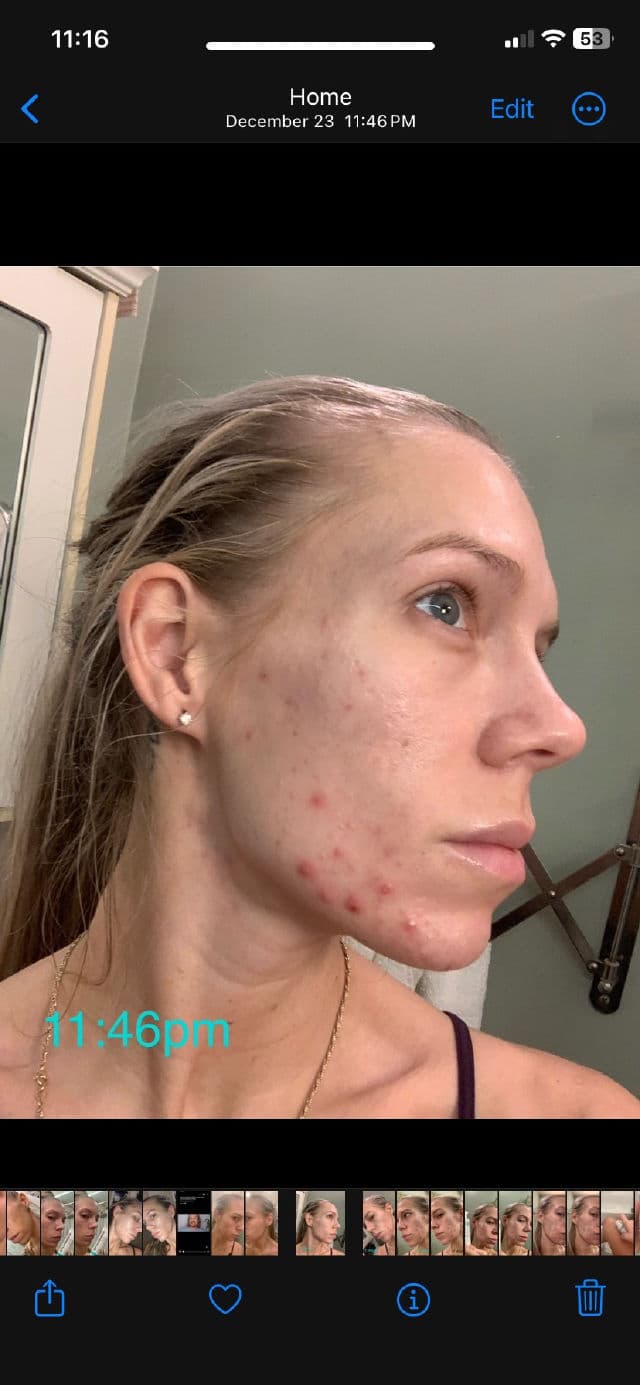 Murad Daily Clarifying Peel review photo by ReneeEgan