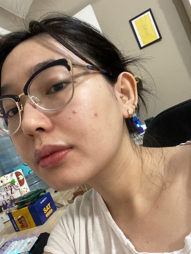 Beplain Cicaterol Ampoule	 review photo by pickystellure