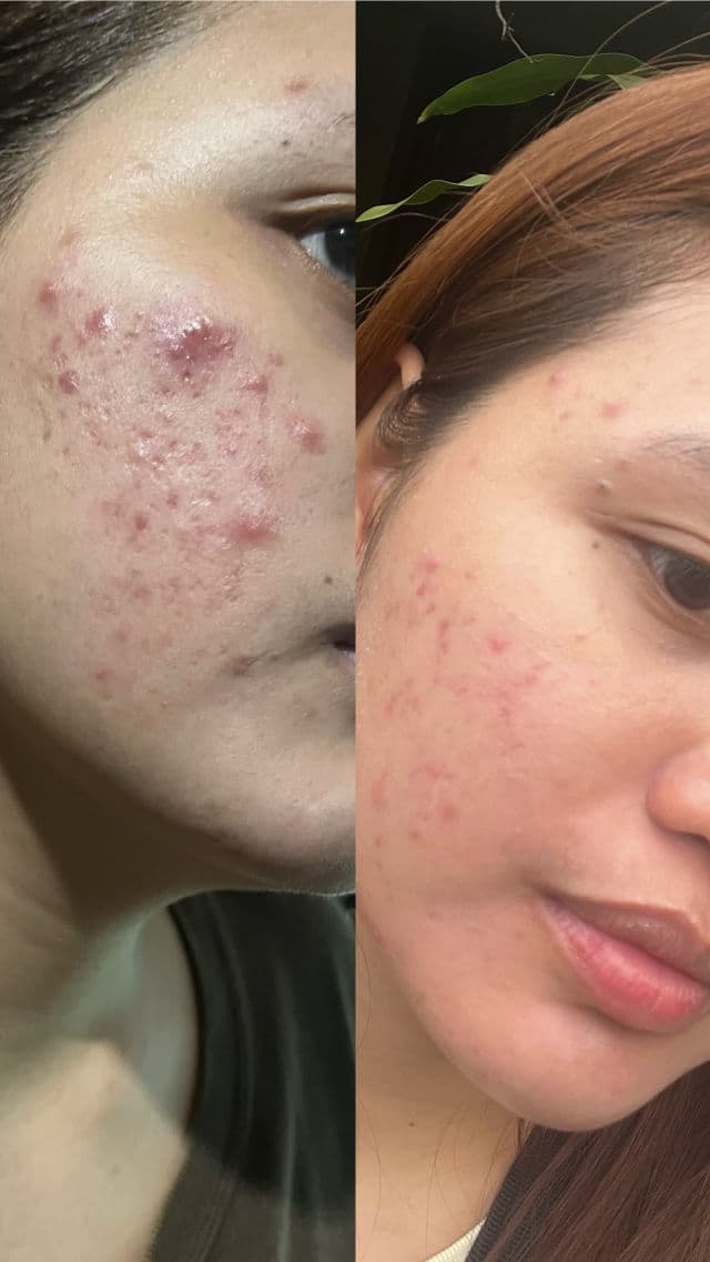 Mary&May Niacinamide + Chaenomeles Sinensis Serum review photo by heyitsannyang