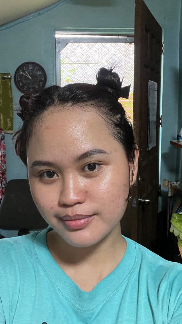 Ellana Cosmetics Clear Skin+ Clarifying Serum With 10% Azelaic Acid (Azeclair) review photo by heyitsannyang