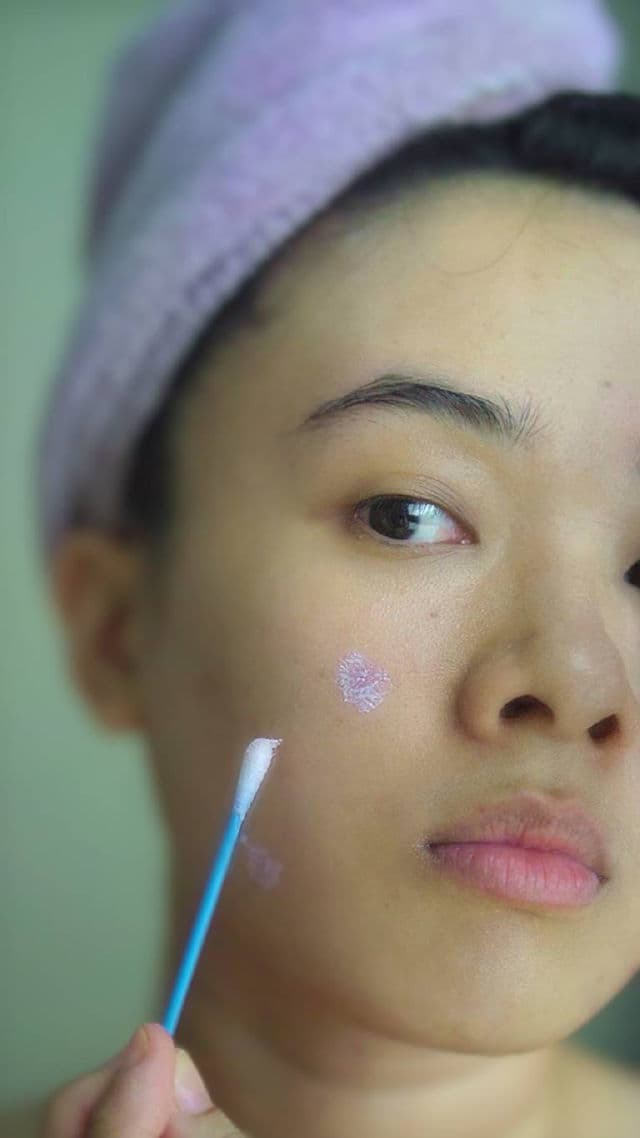 Barenbliss Pimple Warrior! Salicylic Acid Acne Drying Lotion review photo by PickyGlay