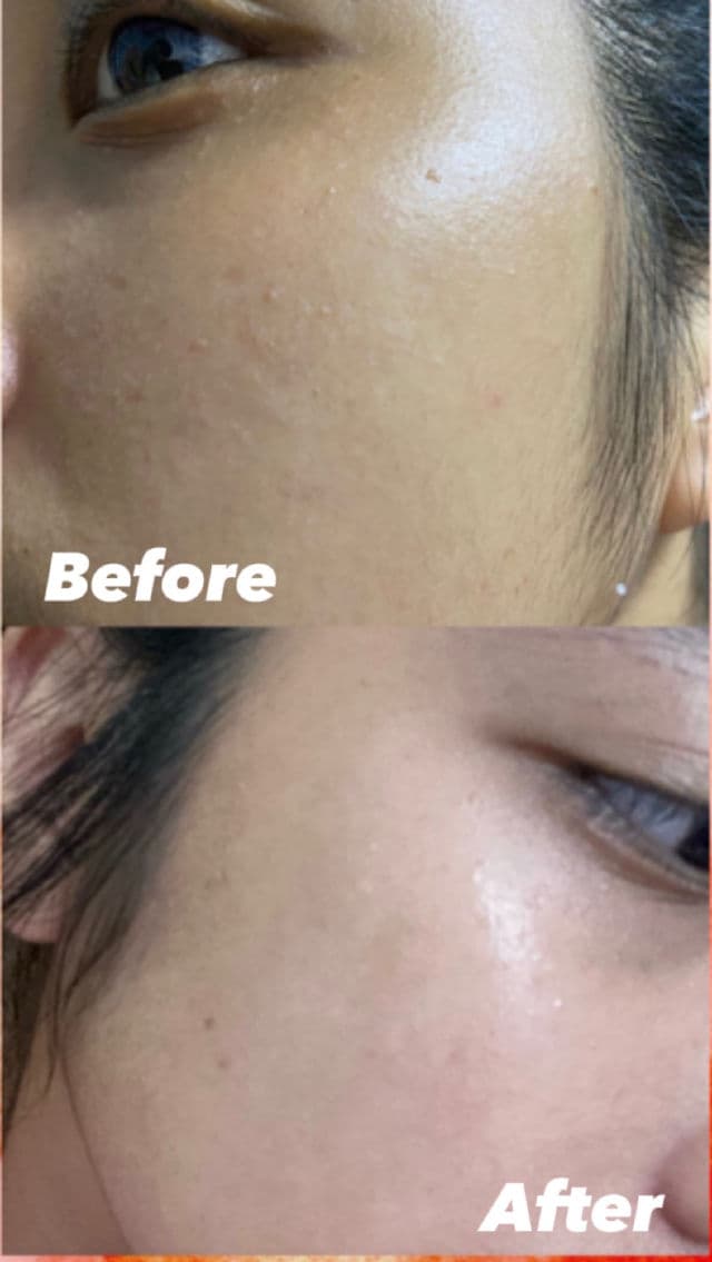 Miguhara Volume Whitening Ampoule review photo by ugcbygianne