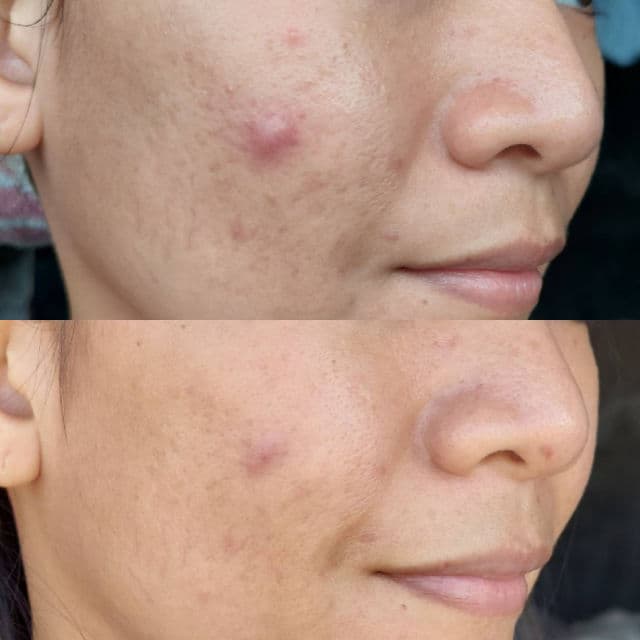 medi-peel Red Lacto Collagen Cream review photo by thatgirlcoffee