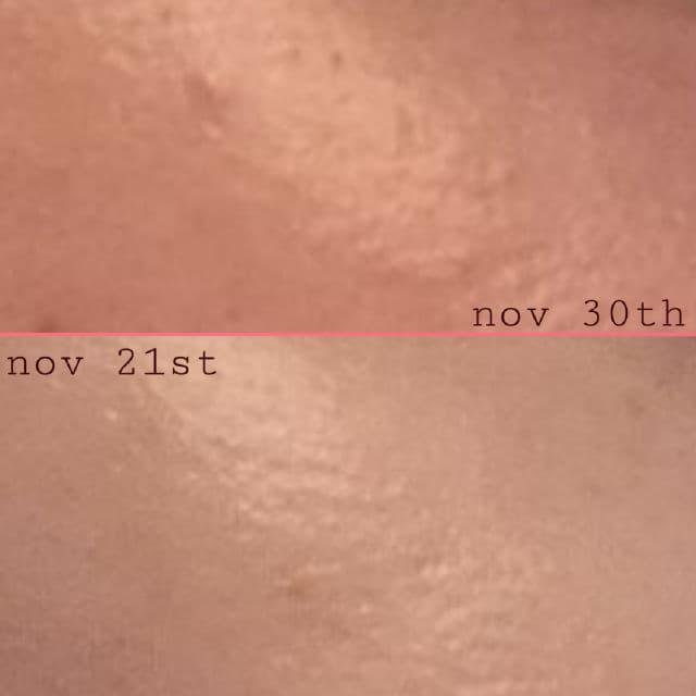 The Ordinary Granactive Retinoid 5% in Squalane review photo by pavementflower
