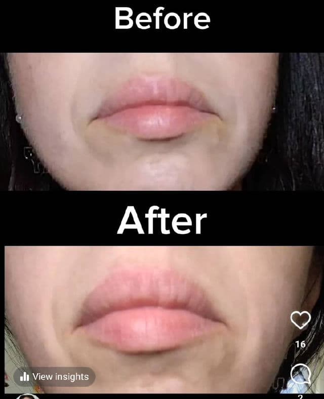 Marée Collagen, Vitamins A, E & Hyaluronic Acid Overnight Lip Care review photo by stacienicole