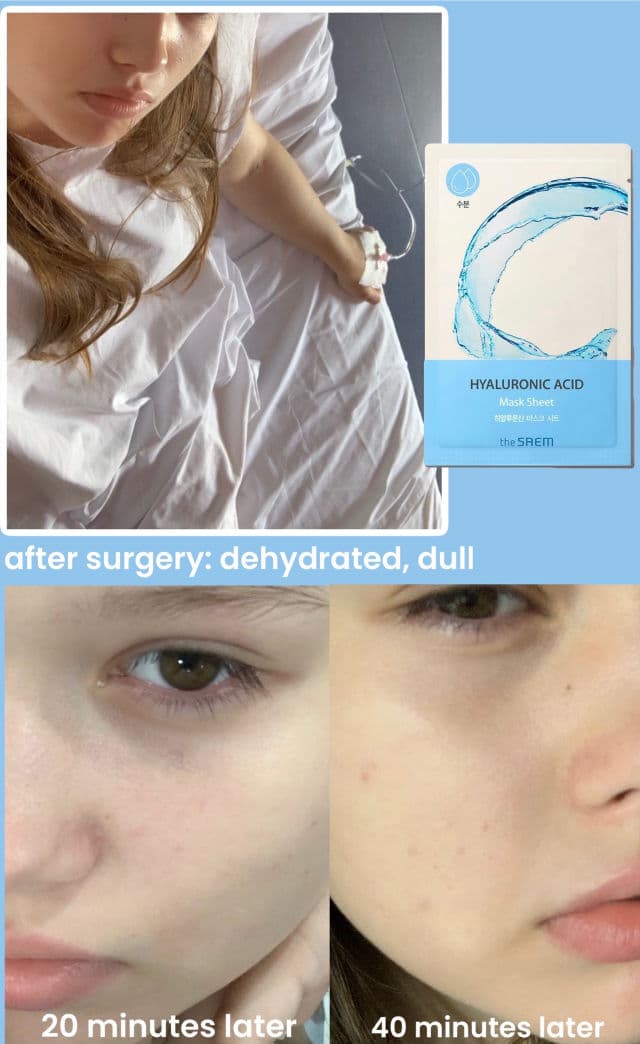 THE SAEM Hydrating Hyaluronic Acid review photo by bunnycake
