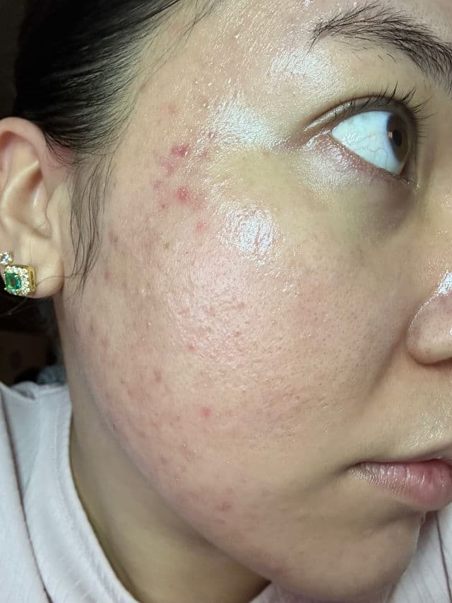 Melano CC Vitamin C Premium Essence product review