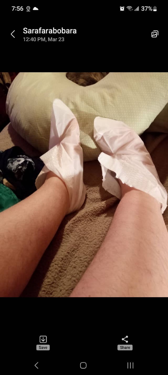 Purederm Shiny & Soft Foot Peeling Mask review photo by laughter