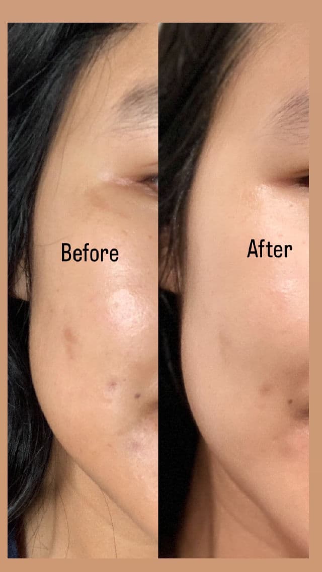Medicube Deep Vita C Ampoule review photo by Muaniecing 