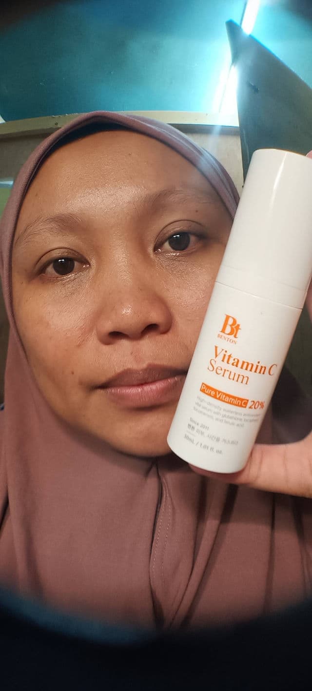 BENTON Vitamin C Serum review photo by jayzkookie87