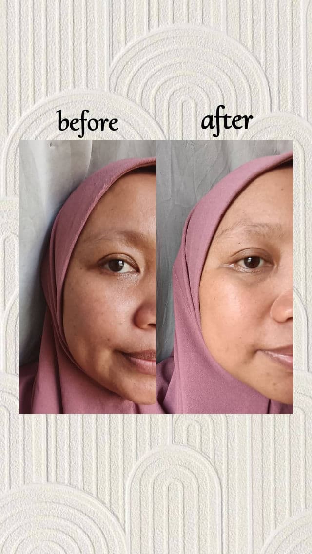 BENTON Vitamin C Serum review photo by jayzkookie87