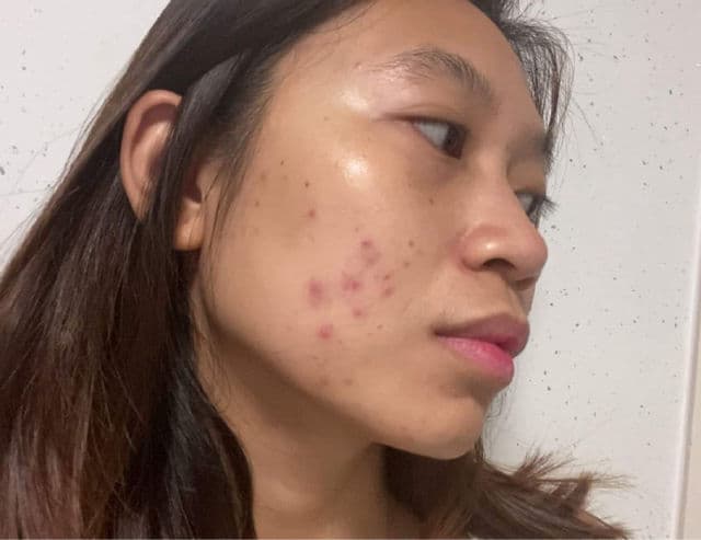 Skin Perfecting 2% BHA Liquid Exfoliant product review