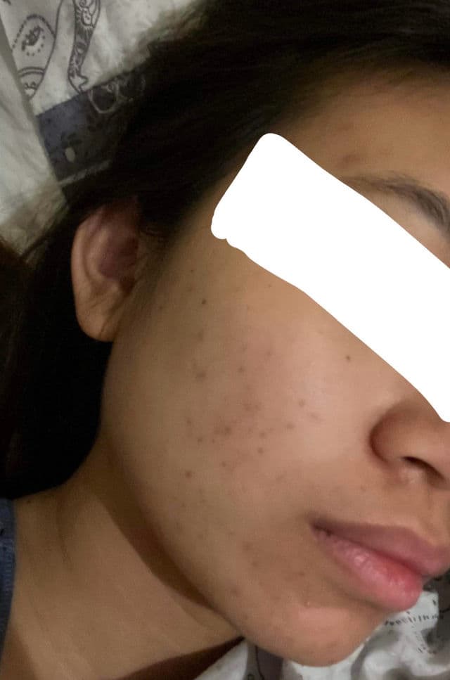 Skin Perfecting 2% BHA Liquid Exfoliant product review