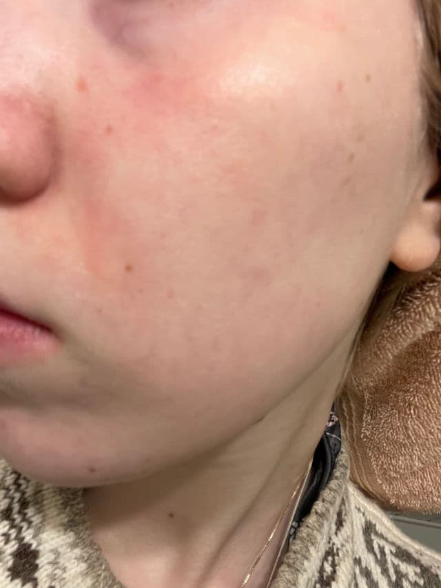 SKINFOOD Pink Grapefruit AHA Toner review photo by aloecaring