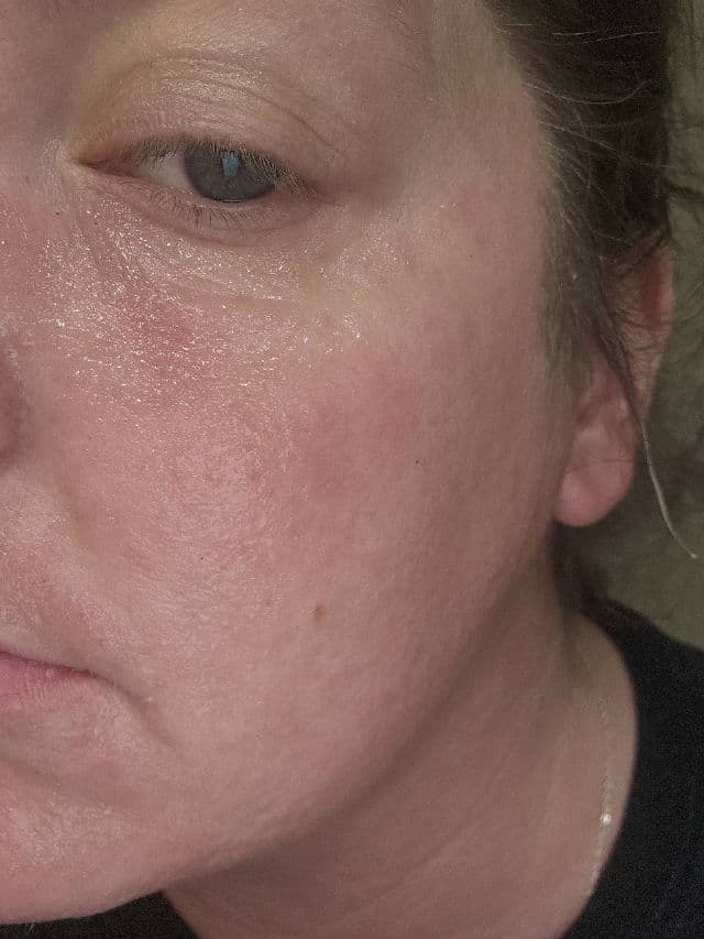 DR.G R.E.D Blemish Cica Soothing Cream review photo by Pumpkin222