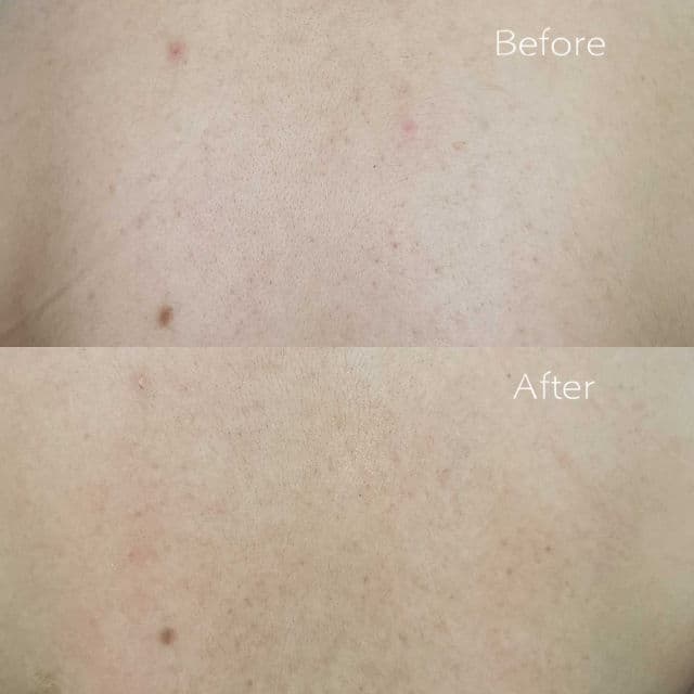 Secret Soft Society T1-001 Body Toner review photo by htebbethhteb