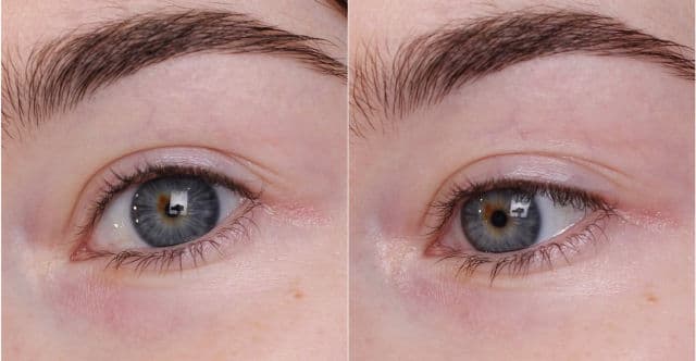 Dr. Althea To Be Eyeconic Eye Serum review photo by Beautynast 