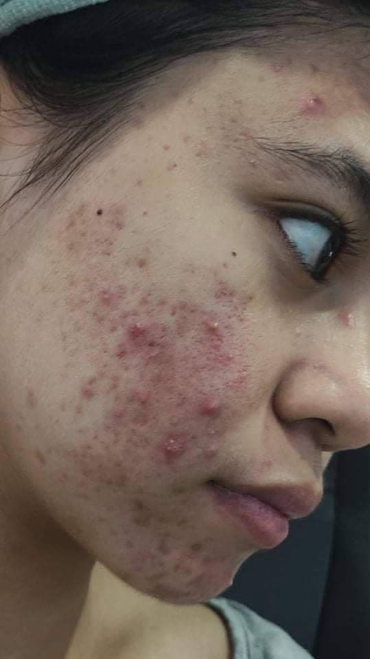 SKIN1004 Madagascar Centella Light Cleansing Oil review photo by crine