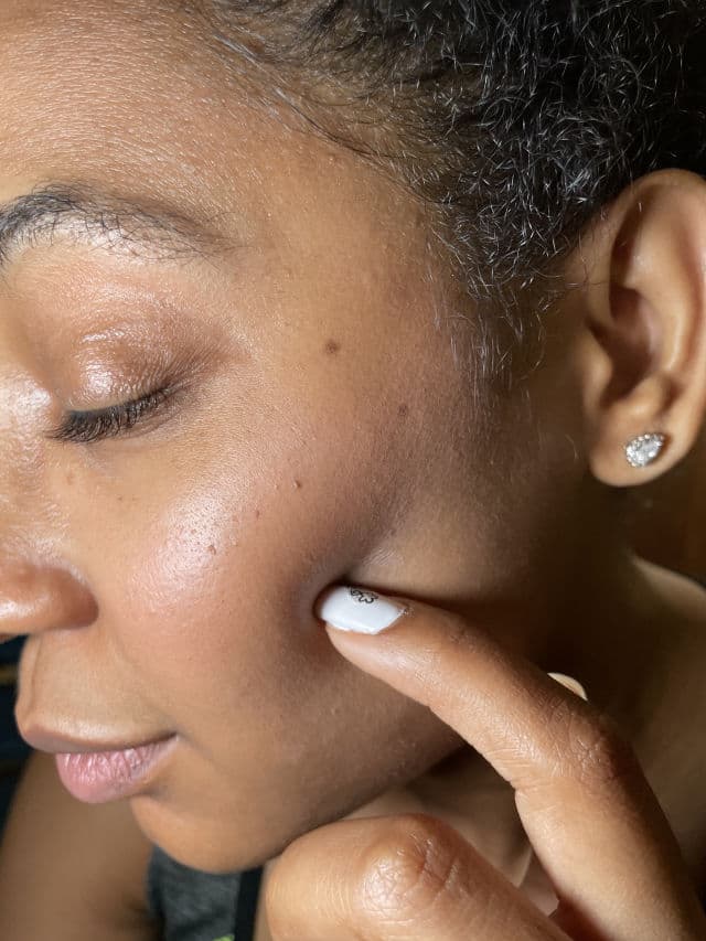 Franz Blemish Recovery Naked Spot Patch review photo by jaziirod