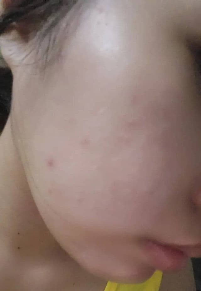 ANUA Niacinamide 10% + TXA 4% Dark Spot Correcting Serum review photo by Eunjia