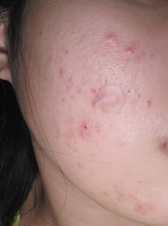 numbuzin No.5 Glutathione Vitamin C Concentrated Serum review photo by Eunjia