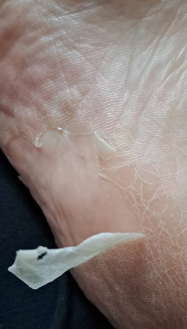 Purederm Exfoliating Heel Mask review photo by ladybird