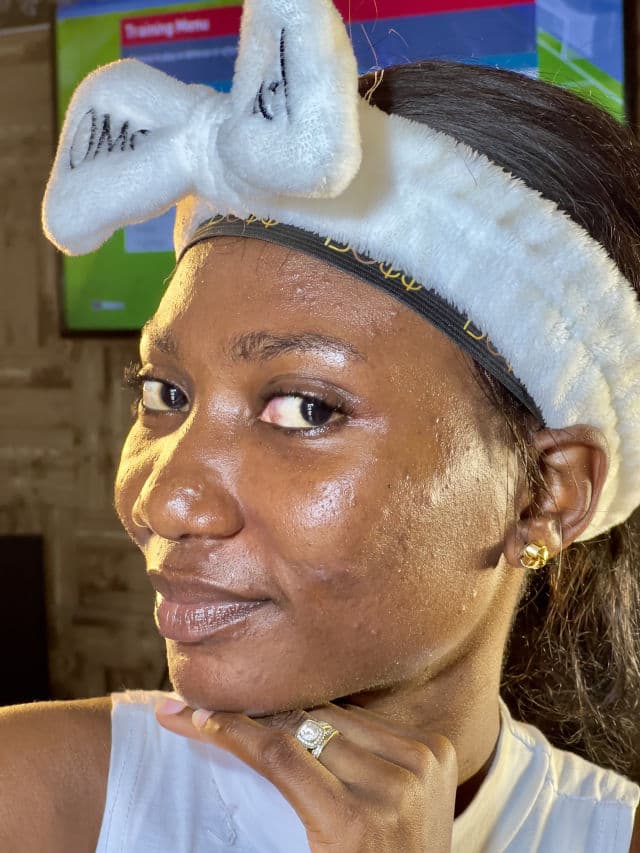 Easydew DW EGF Melatoning One Day Ampoule review photo by Abenaah