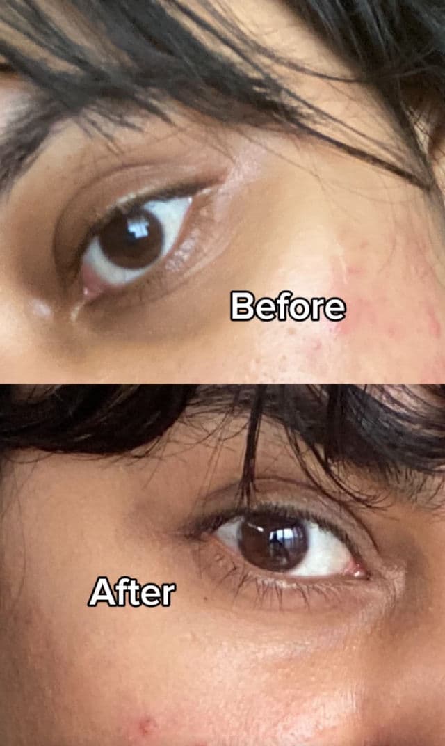 Clarins Double Serum Eye review photo by Aanchal