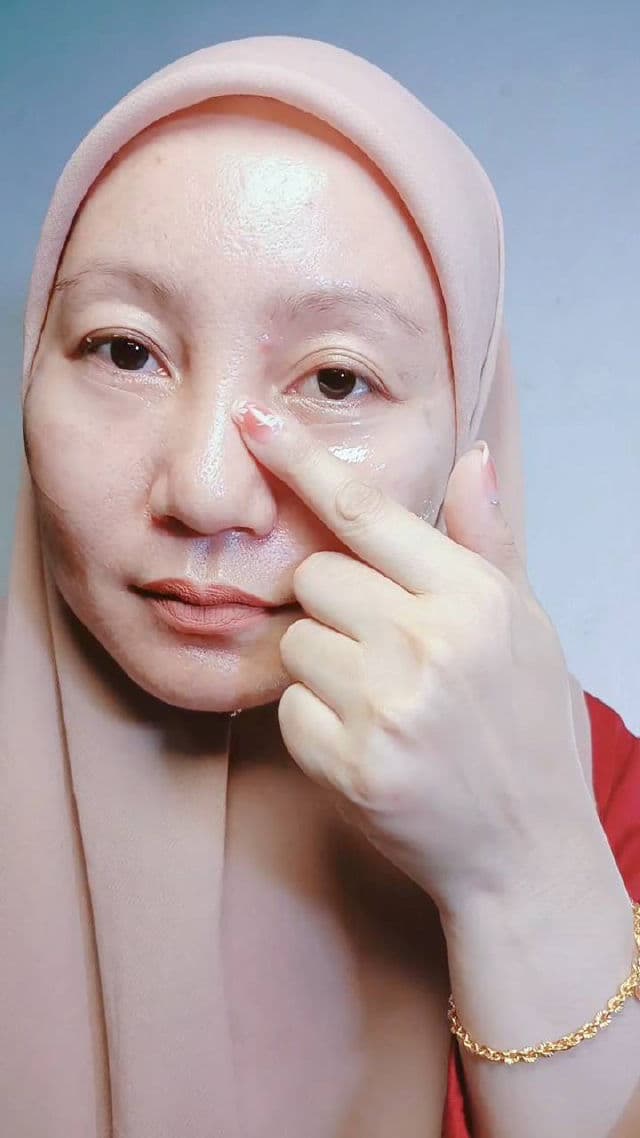 Meditherapy Wrinkle-Fit Tangle Eye Patch review photo by Arisah