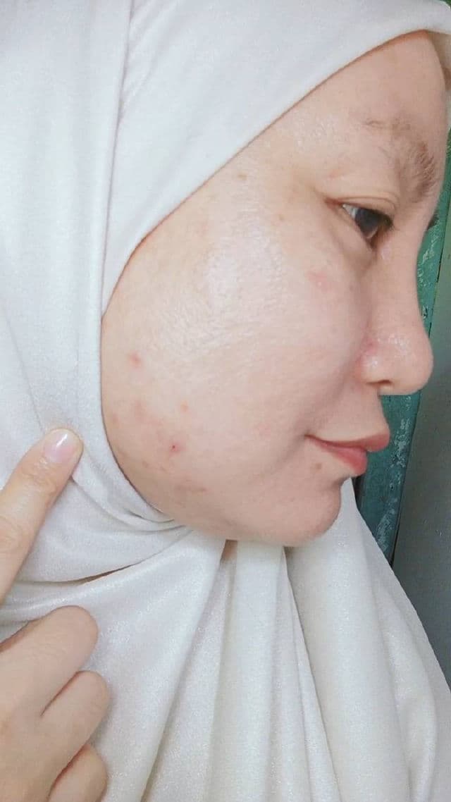 Dr. Althea 345 Relief Cream review photo by Arisah