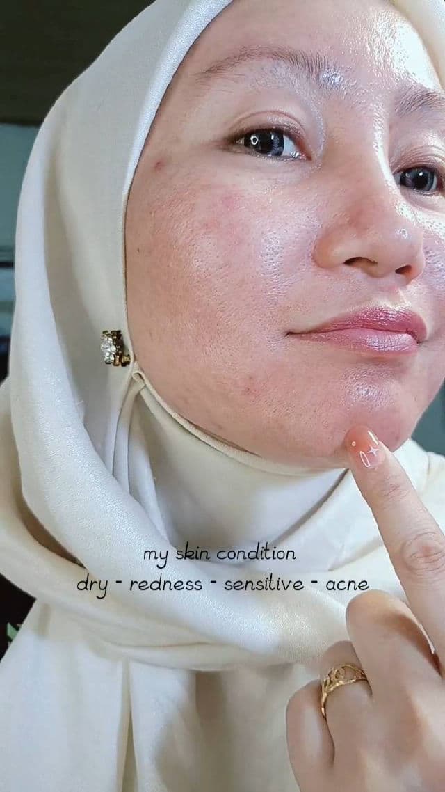 I'M FROM Rice Toner Pad review photo by Arisah