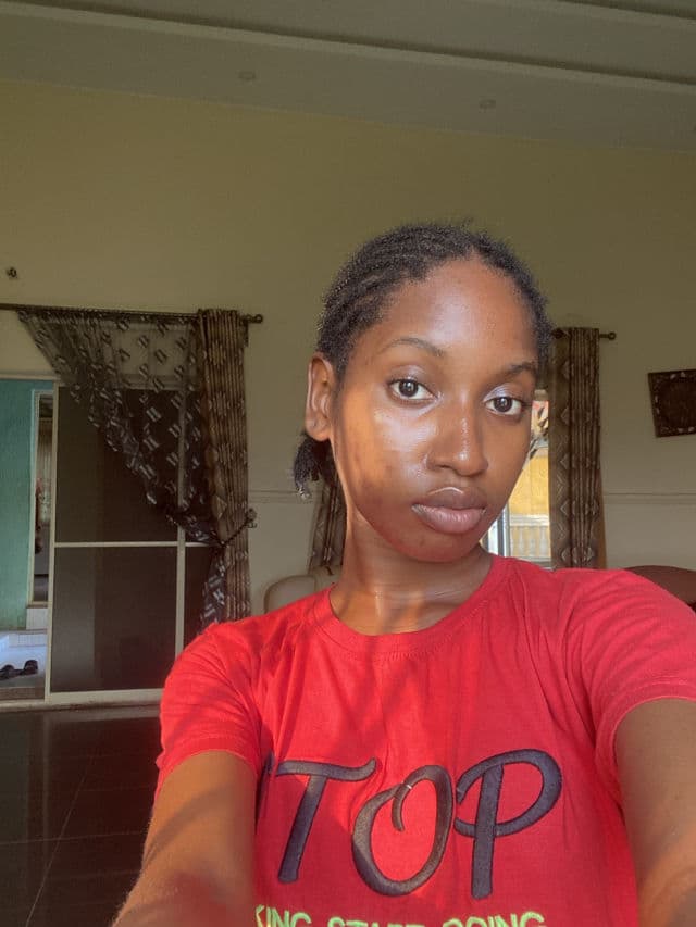 Dr.Rashel White Skin Whitening Fade Spots Serum review photo by peacenaza