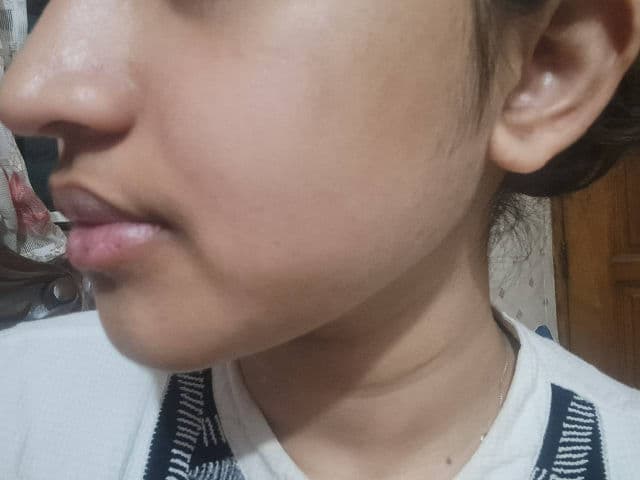 Meditherapy Retinal Skin Booster Serum review photo by NusratJahan123