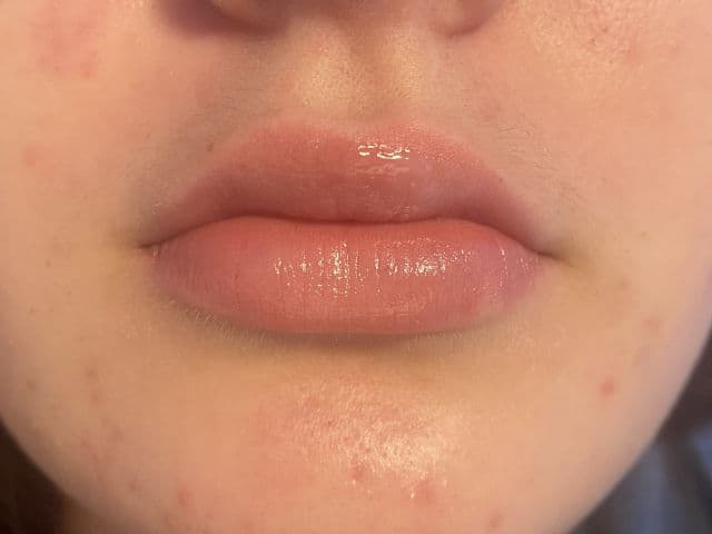 Glossier Original Balm Dotcom review photo by rosesocialhub