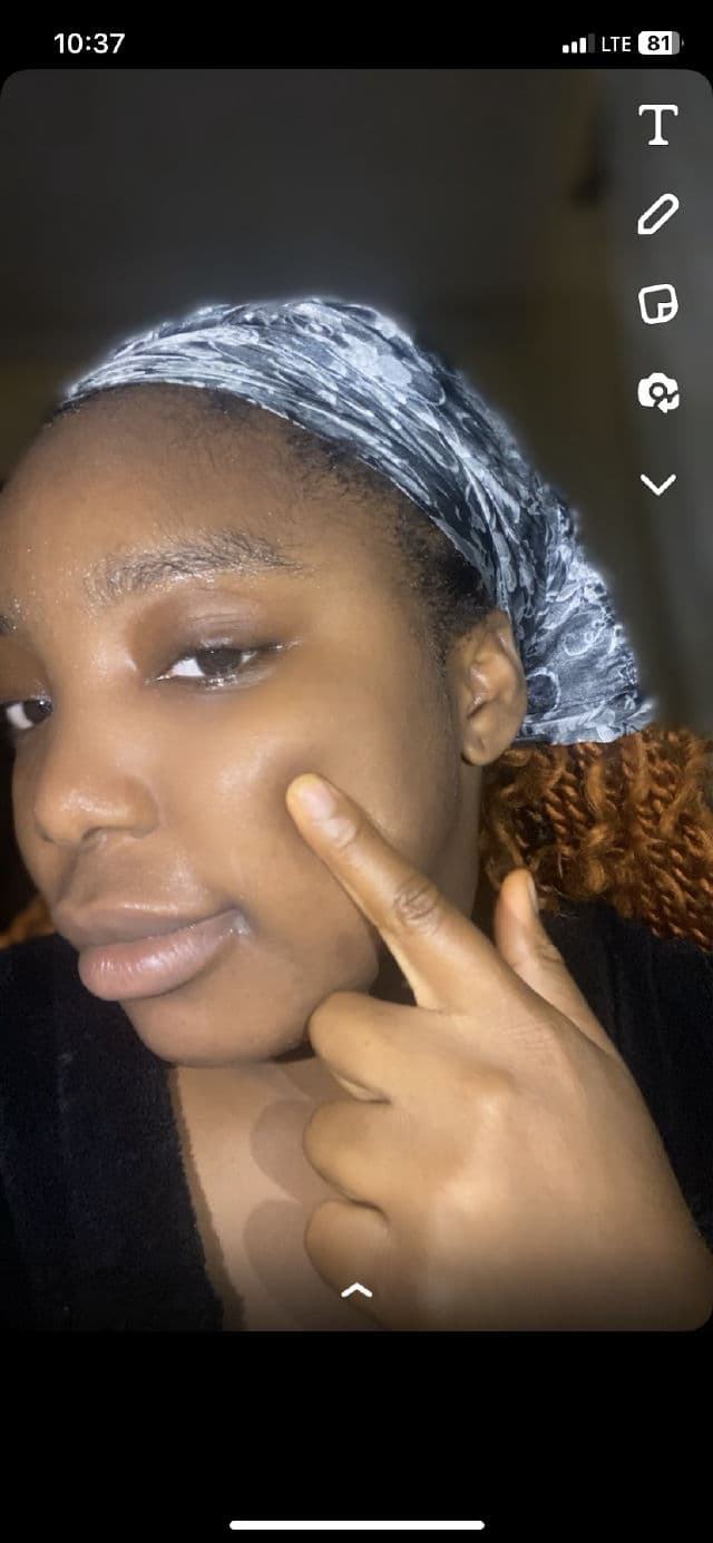 Orjena Natural Moisture Collagen Mask Sheet review photo by Veeey