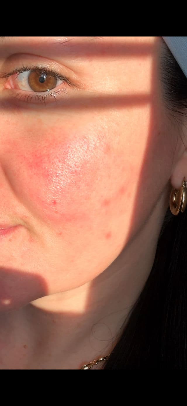 SKIN1004 Madagascar Centella Ampoule Foam review photo by Tatyk2913