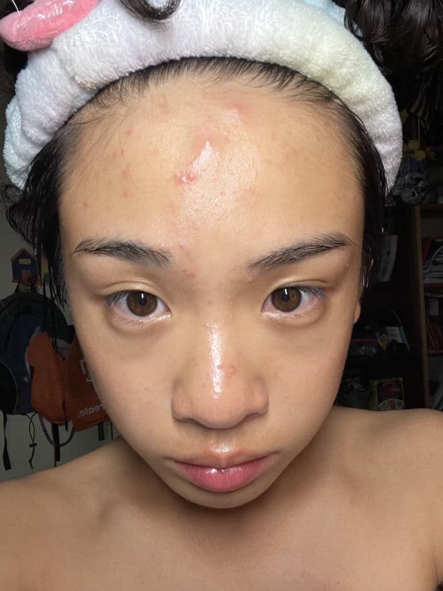 Madagascar Centella Ampoule product review
