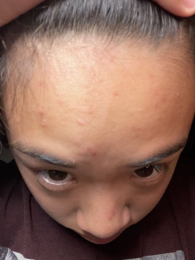 Madagascar Centella Ampoule product review