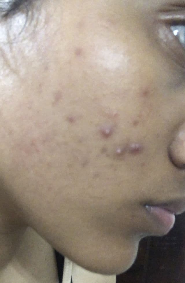 ANUA Niacinamide 10% + TXA 4% Dark Spot Correcting Serum review photo by Saminaa