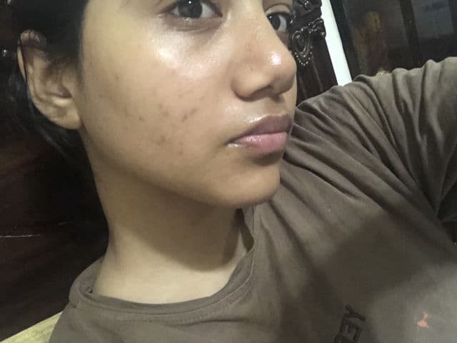 ANUA Niacinamide 10% + TXA 4% Dark Spot Correcting Serum review photo by Saminaa