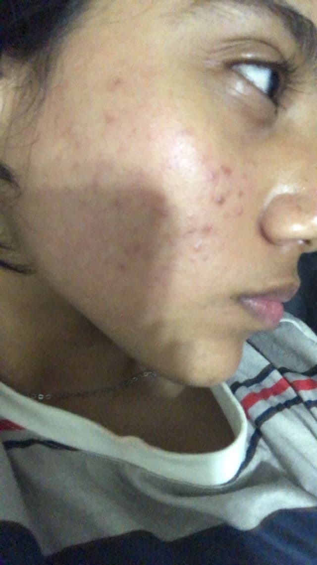 TIRTIR Calm Down Bubble Toner review photo by Saminaa