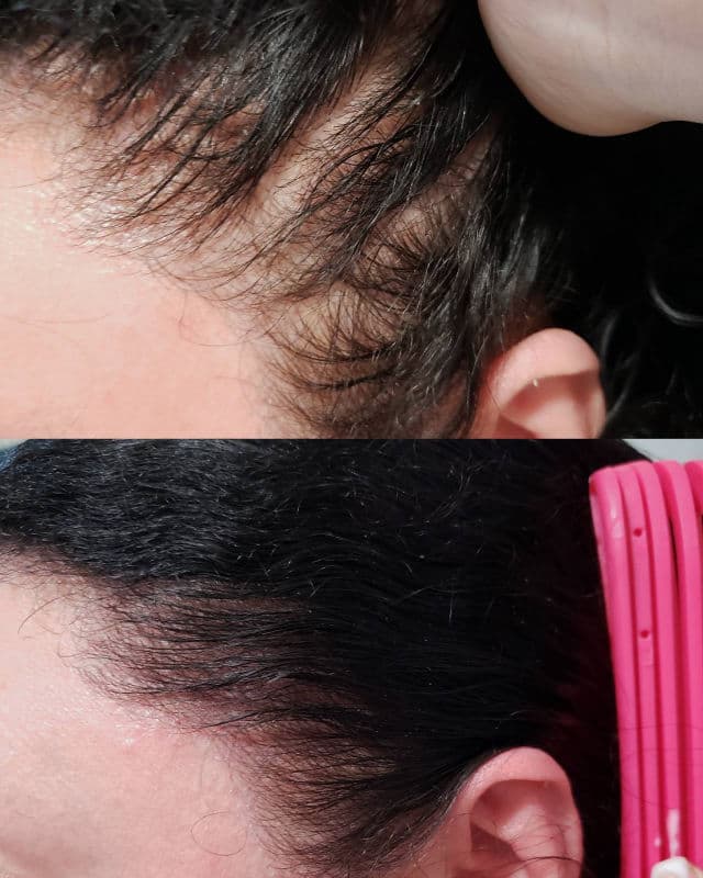 Dr.FORHAIR Folligen Original Tonic review photo by AlottaxReviews