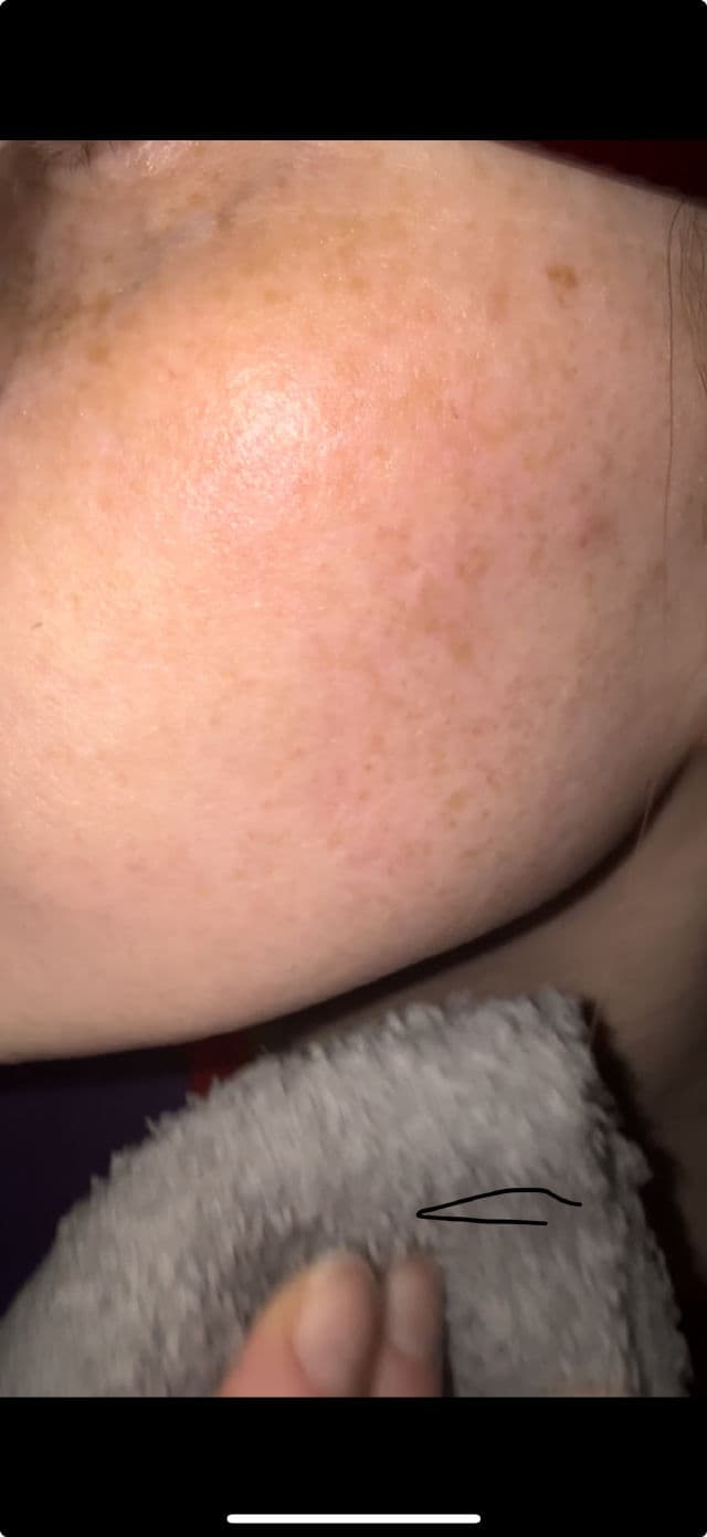manyo Galactomy Enzyme Peeling Gel review photo by fxckcay