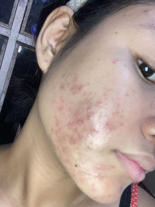 The Originote Mugwort B3 Clay Stick Mask review photo by AngelPedralvez