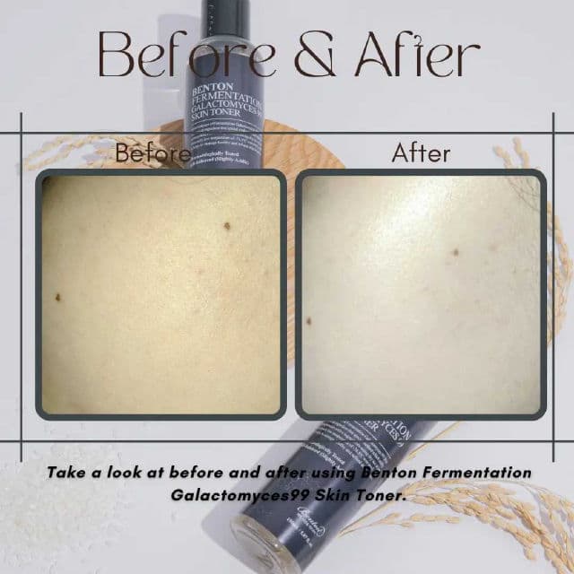 Fermentation Galactomyces 99 Skin Toner product review
