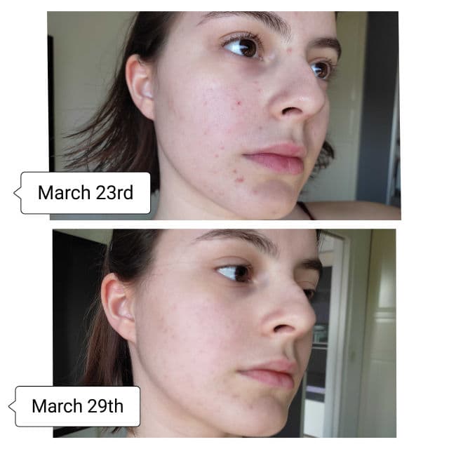 Babor Active Purifier Ampoule Serum Concentrates review photo by skincareandcaro